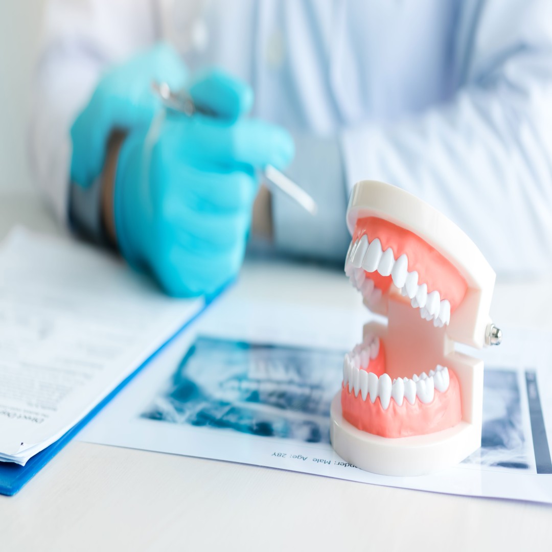 Total Protez ve Manyetikli Total Protez Arasındaki Farklar: Tutuş, Stabilite ve Fonksiyonel Avantajlar | 