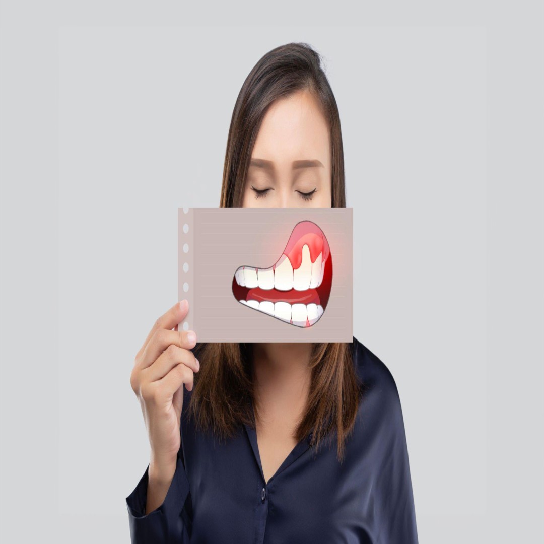 Apse Durumunda Dişin Çekilmesi: Değerlendirme ve Tedavi Yaklaşımları | 