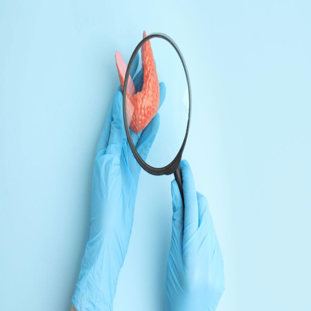 Tiroit Nodüllerinin Oluşumunda Etkili Faktörler ve Tedavi Seçenekleri | 